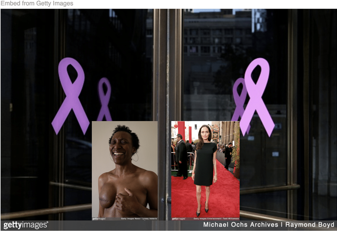 Image marking breast cancer awareness month with inset image of woman with mastectomy and another of Angelina Jolie with he new bullet breasts.